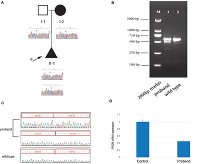 Case Report: Compound Heterozygous Phosphatidylinositol-Glycan Biosynthesis Class N (PIGN) Mutations in a Chinese Fetus With Hypotonia-Seizures Syndrome 1